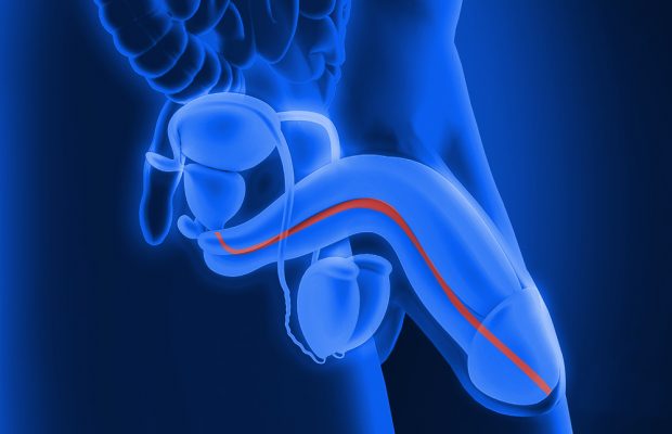 Anuncian  jornada para hombres con problemas en la uretra