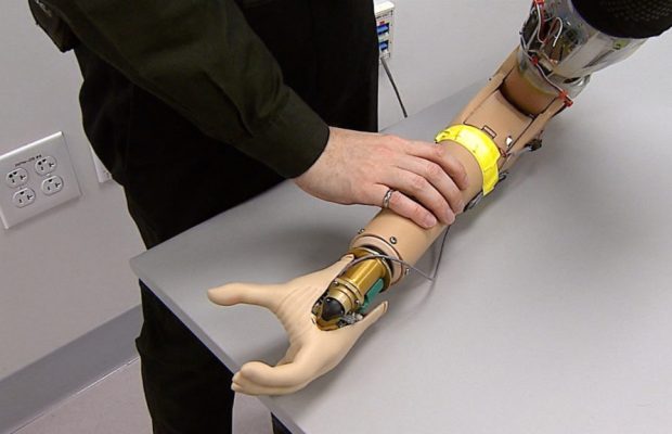 Brazo protésico biónico, nuevo descubrimiento para amputaciones