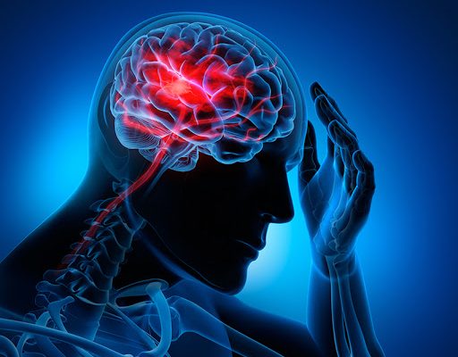 COVID-19 y los accidentes cerebrovasculares (ACV)