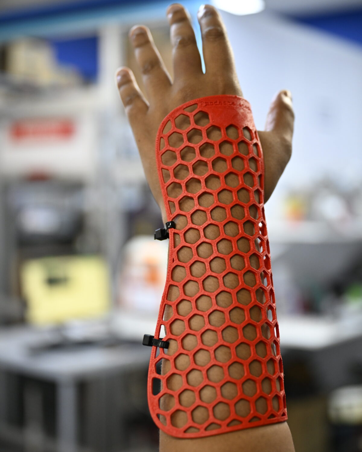 Jóvenes de INTEC fabrican férulas 3D para Venezuela
